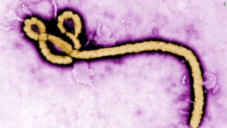 Ebolavirus.jpg