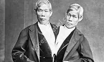 chang-and-eng-siamese-twins.jpg
